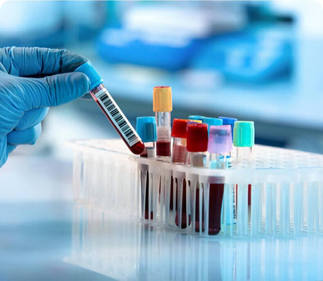 Doble Marcador Bioquímico (Dúotest)