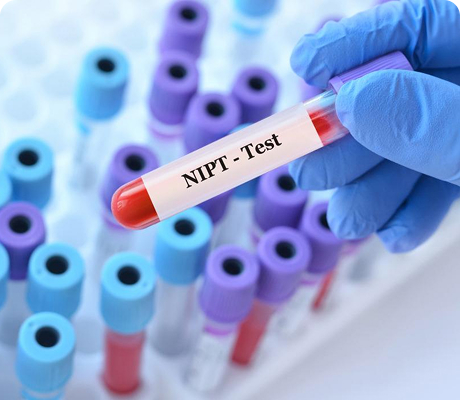 DNA Fetal en Sangre Materna (cfDNA)
