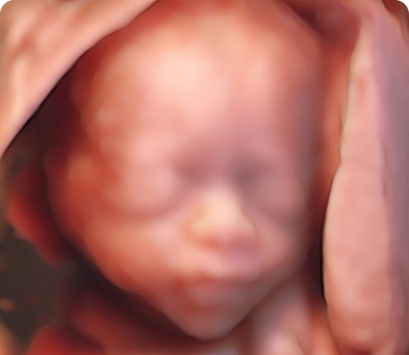 Ultrasonido 3D, 4D y 4D Live